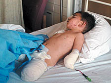 An Iraqi child in hospital after being injured during the America attack on Fallujah in January 2005